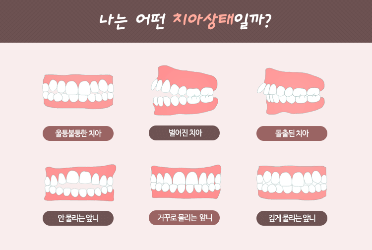 교정치료의 대상 이미지